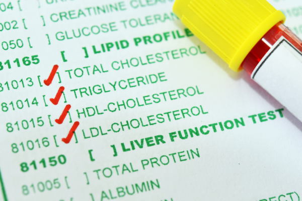 Canva Blood sample tube for lipid profile test